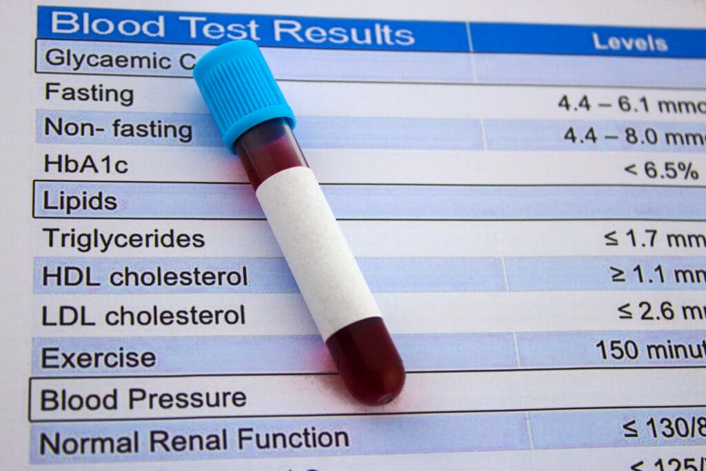Beginners Guide To Cholesterol Testing