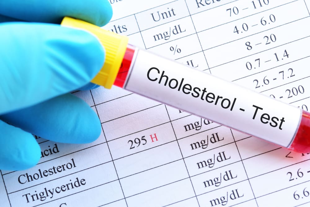 Cholesterol Testing: What You Need To Know