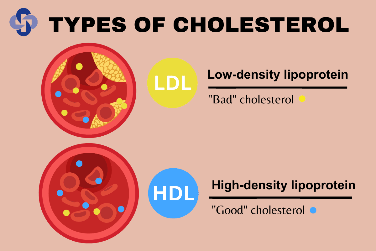 Understanding The Different Types Of Cholesterol And Their Effects