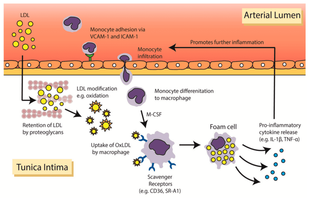 Understanding The Role Of Inflammation In Heart Disease And Cholesterol Levels