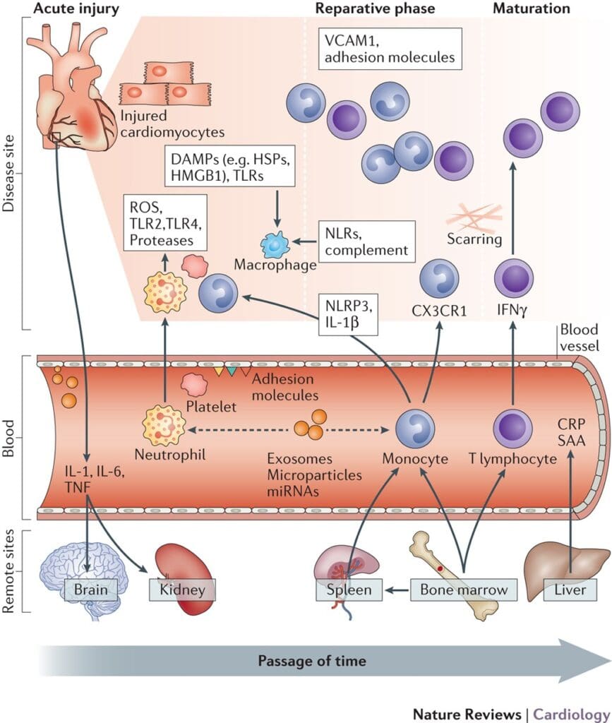 Understanding The Role Of Inflammation In Heart Disease And Cholesterol Levels