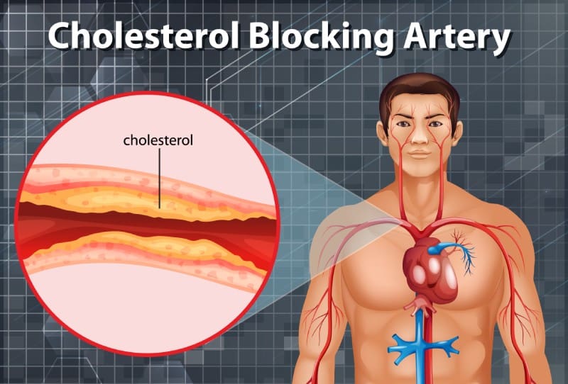 What Is Cholesterol And How Does It Affect Your Heart?