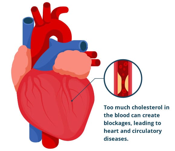 What Is Cholesterol And How Does It Affect Your Heart?